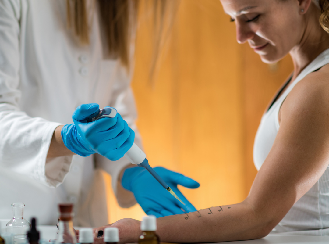 Allergy Testing