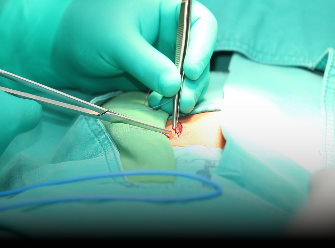 Suturing Cuts and Lacerations